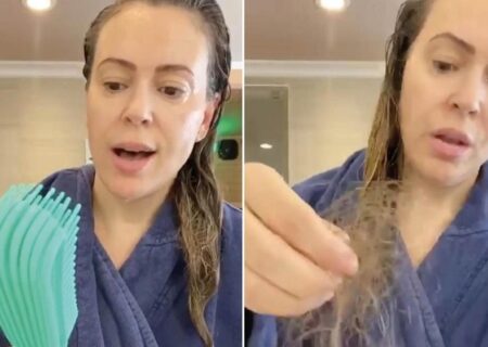 کرونا چه موقعی باعث ریزش مو میشه و مو میریزه ؟