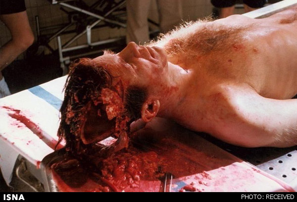 لحظه ترور و اصابت گلوله به صورت «کندی» رئیس جمهور آمریکا (۱۶+) + عکس