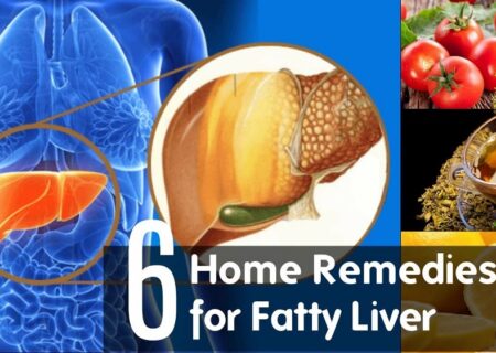 درمان کبد چرب در خانه و به روش سنتی و خانگی