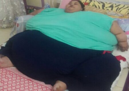 زن ۵۰۰ کیلویی ۲۵۰ کیلو لاغر شد + تصاویر