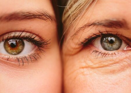 چین چروک صورت و چشم