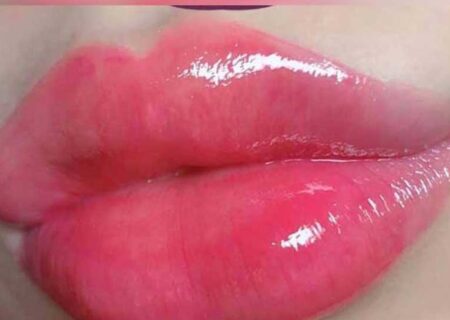 آسیب های بالم لب را بهتر است بدانید