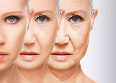 درمان شلی و افتادگی پوست بازو و بدن بدون جراحی