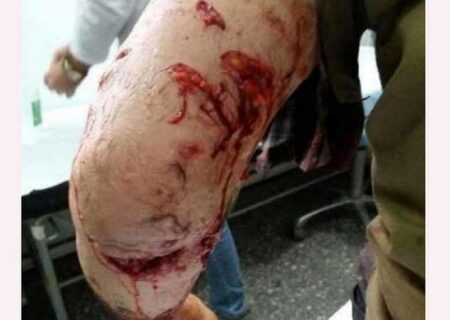 حمله پلنگ به چوپان گیلانی / چوپان در کما به سر میبرد + عکس