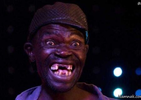 سرگرمی دیدنی ها جنجال در مسابقه زشت ترین مرد جهان + تصاویر